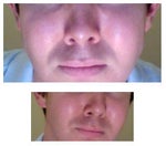 26 year old thin/skinny male with prominent cheeks