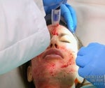 All the details on Kim's bloody facial.