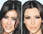Kim Kardashian bad celeb Botox
