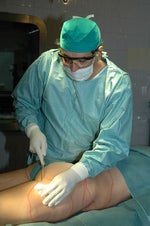 Liposuction surgery can cause death