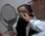 young Korean girl eyelid surgery