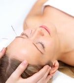 Acupuncture facelift