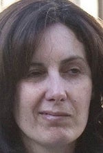 Penny Johnson after botched facelift
