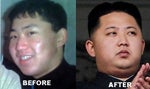 Kim Jong-un gets plastic surgery to better resemble Kim Jong-il and Kim Il-sung