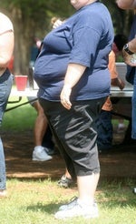 Obese patients face surgery concerns
