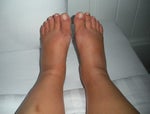 how to fix cankles