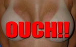 Photo evidence that women like to flaunt their new boobs.