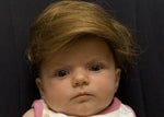 How to get more hair