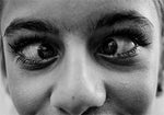 Not just for wrinkles: 5 Different Uses for Botox