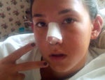 kids and plastic surgery