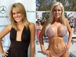 Heidi Montag plastic surgery