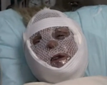 Kyle's mother-in-law following a facelift by Paul