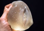Ruptured PIP Implant courtesy of GlobalPost