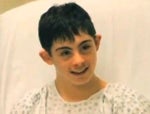 otoplasty for Down's syndrome