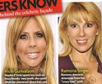 Real Housewives wrinkles