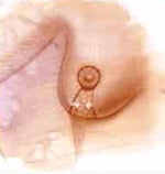 breast reduction guide for women wanting smaller breasts