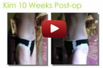 Video Tummy Tuck Webinar