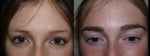 eyebrow