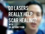 surgery scars laser treatment video