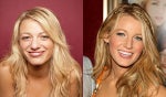Celebrity Plastic Surgery Secrets, Tattoo Removals & More