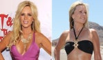 5 Celebrities Who Got Their Breast Implants Removed