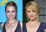 Six Celebs Who Had Rhinoplasty