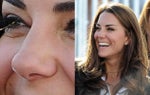 Salma Hayek, Kate Middleton: The Most Requested Noses