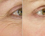 Skin Care before and after photos