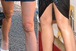 Did Demi Moore Get a Knee Lift?