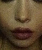 Twisted nose