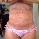 Does anyone else know that The Wall Street Journal calls Smartlipo Propaganda?