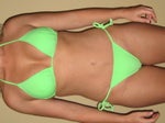 8 months after surgery