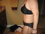 One week post op