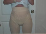 2 days post op with lovely girdle.