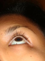 Week 6 Latisse