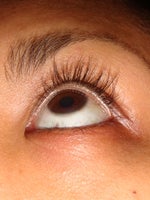 Week 18 Latisse