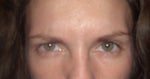 concaved eyebrow