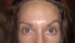 Uneven eyebrows