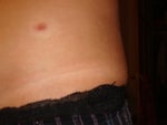 rrrrrrr.I hate that scar..