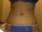 after pic, took on 2/20, front