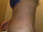 after pic, took on 2/20, side