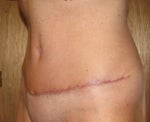 Left view - 4 weeks