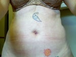 this is me, 7 months after, pretty sad
