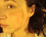 2nd treatment 3 months+ after the 1st. stronger peel-about 20-25%