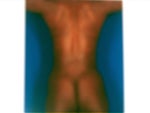 6 wks. prior back view