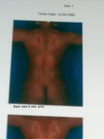 6 wks. pre back view