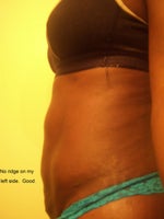 Here you could clearly see no ridge on my left side