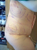 At 5 days, side view, dont mind the marker