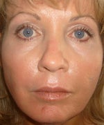 8 days post