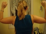 Three weeks postop